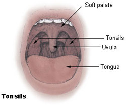 Ilustração da boca e da localização das amígdalas