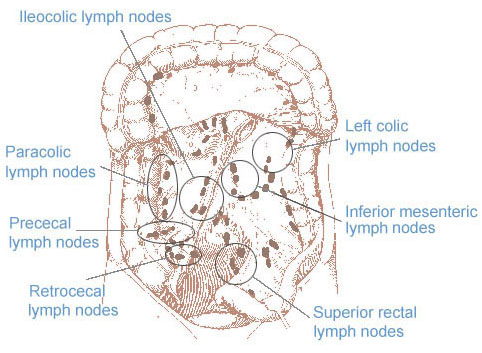 Illustration of colorectal lymph nodes.