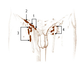 Numbered illustration of the superficial inguinal lymph nodes