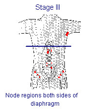 Illustration of Stage III: Node regions both sides of diaphragm