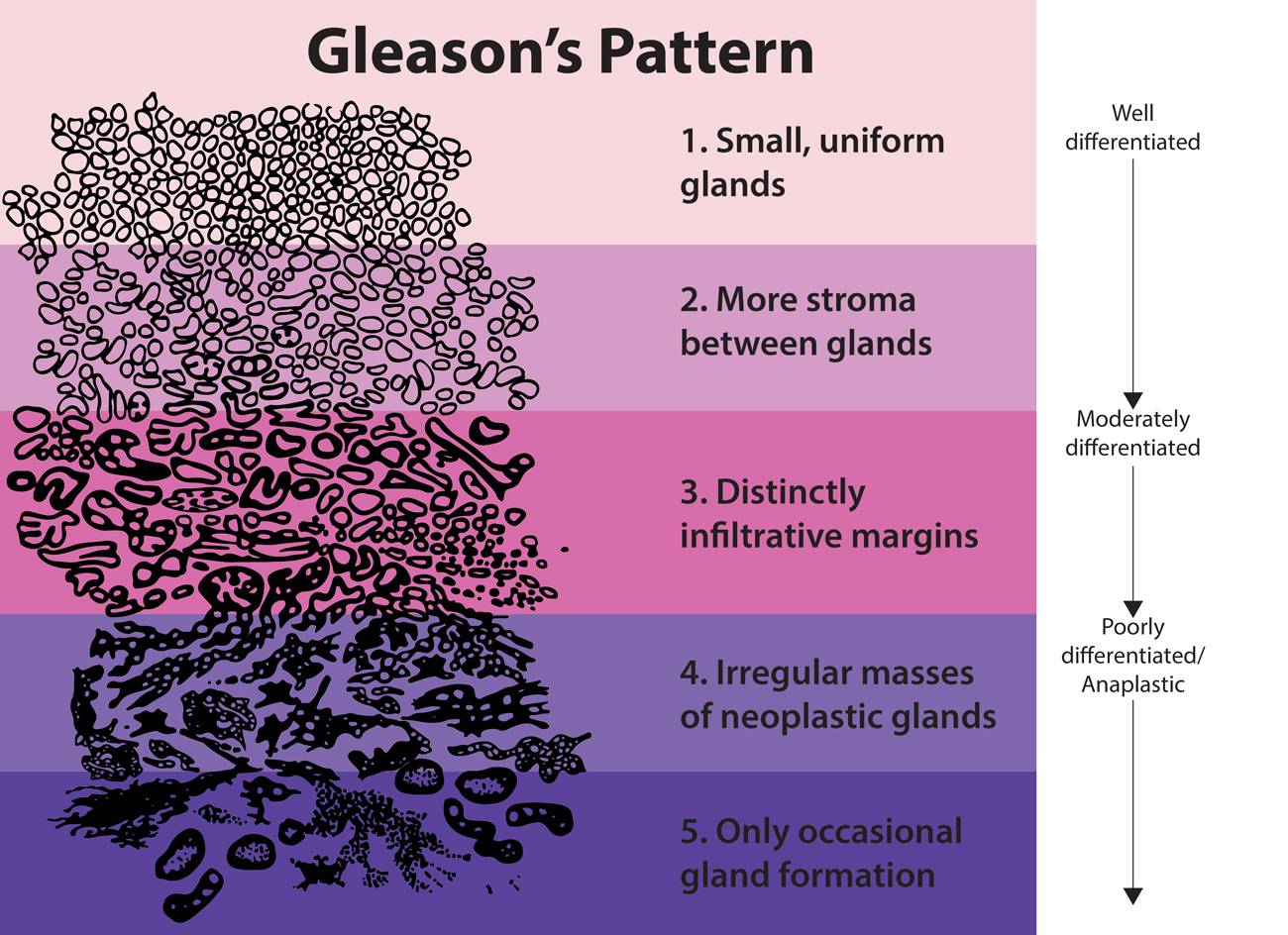 pattern formation v chart & Training:Morphology Grade SEER