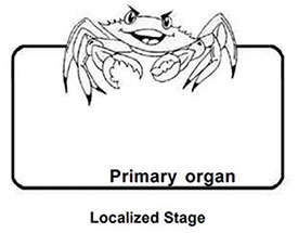 A localized cancer is a malignancy limited to the organ of origin; it has spread no farther than the organ in which it started. There is infiltration past the basement membrane of the epithelium into the functional part of the organ, but there is no spread beyond the boundaries of the organ. A tumor can be widely invasive or even show metastases within the organ itself and still be considered “confined to organ of origin” or localized in summary stage.